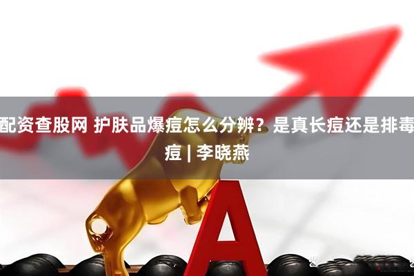 配资查股网 护肤品爆痘怎么分辨？是真长痘还是排毒痘 | 李晓燕